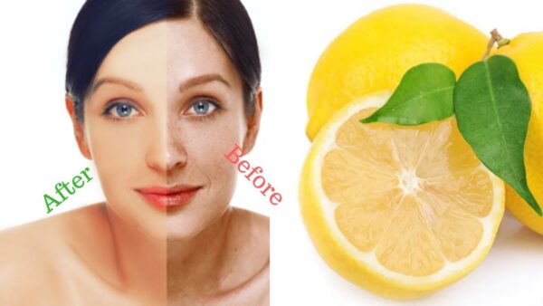 Unlocking the Secrets of Lemon Juice: The Ultimate Dark Spot Remover